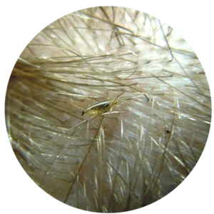 Nit Wits : FAQ : About Head Lice : AirAllé™