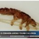 Screenshot from a news segment about how head lice is common among young children